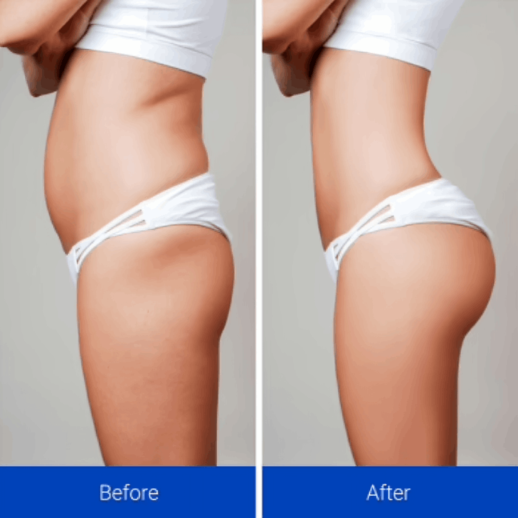 NavaMax ABS Stimulator customer~Andrea - week 8 – Florida, USA